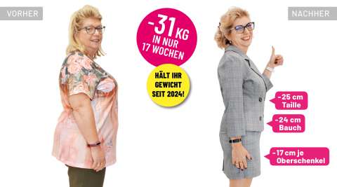 Susanne Györög vor und nach 31 Kilogramm Gewichtsverlust trotz Lipödem